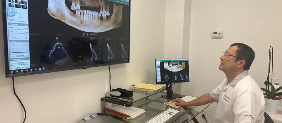 Fix Chipped Teeth with Veneers in NJ | Dr. Carranza