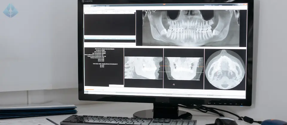 Cosmetic Dental Implants NJ Dr. Carranza