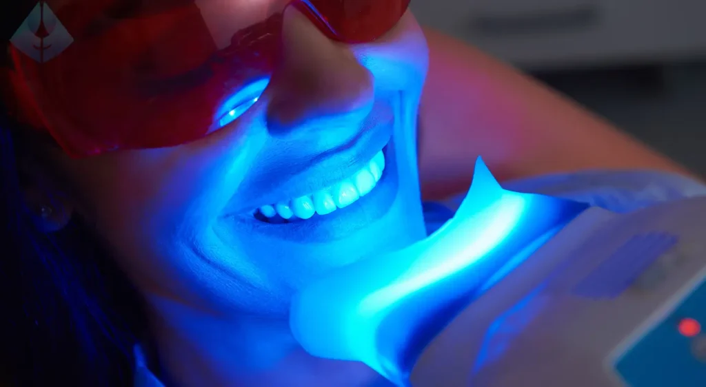 How to Maintain White Teeth for Years to Come